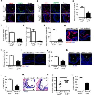 Semaphorin 7A Promotes VEGFA/VEGFR2-Mediated Angiogenesis and Intraplaque Neovascularization in ApoE-/- Mice